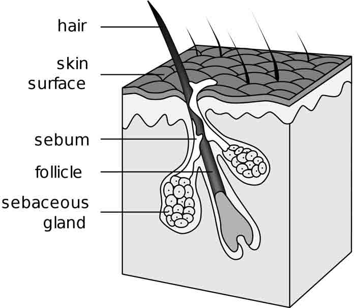 forming of pimple and Sebaceous glands