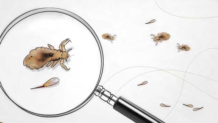 indentify lice eggs on your own