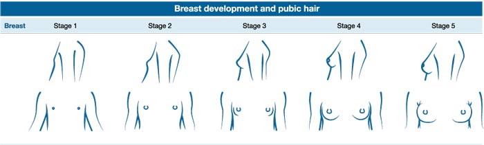 girls breast development and stop